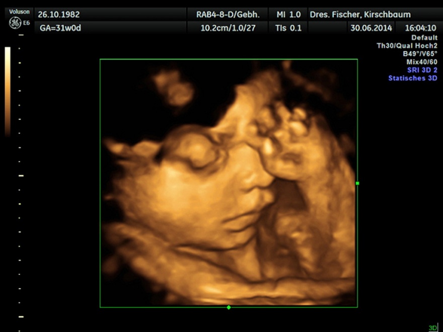 3D/4D-Ultraschall in der Schwangerschaft - Frauenarzt Augsburg Dr. Fischer & Kirschbaum